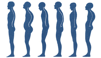 Abstract illustration of body observation points used during posture pattern assessment